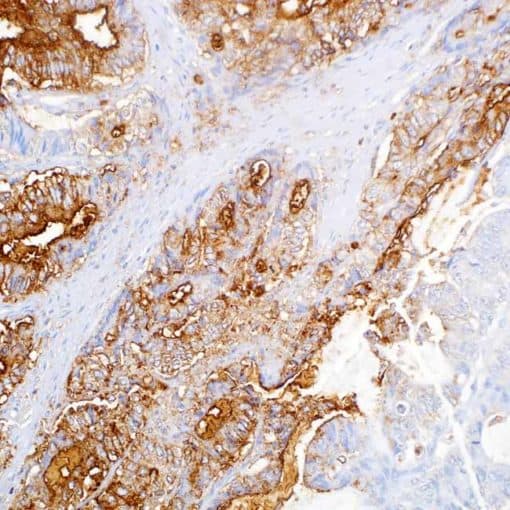 CA 19-9 (121SLE) Mouse Monoclonal Antibody