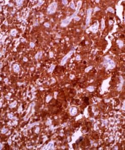 ALDH1A1 (44) Mouse Monoclonal Antibody