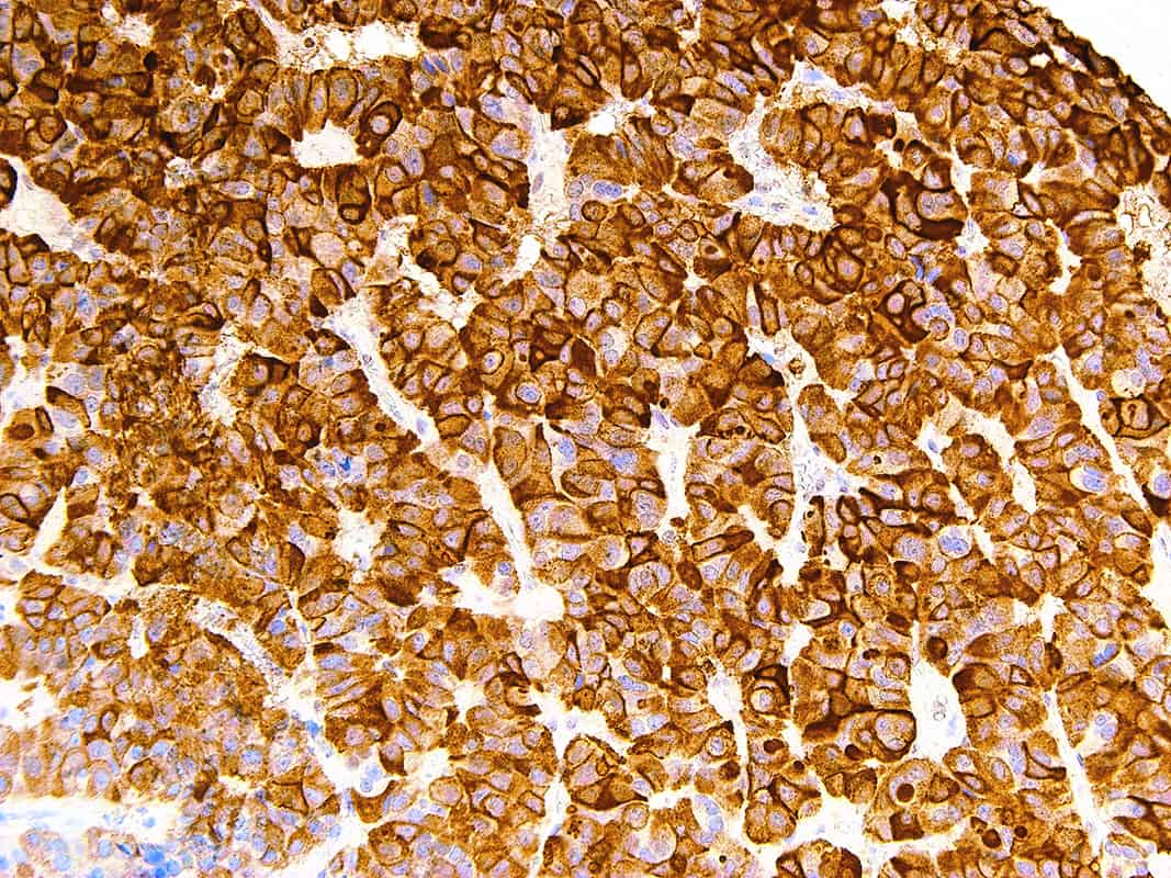 Luteinizing Hormone (LH) | Medical Supply Company