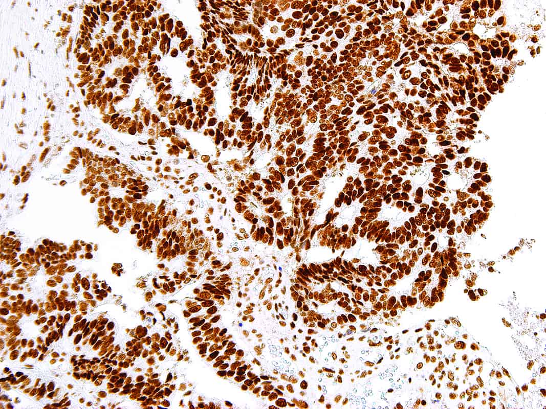 MSH2 | Medical Supply Company