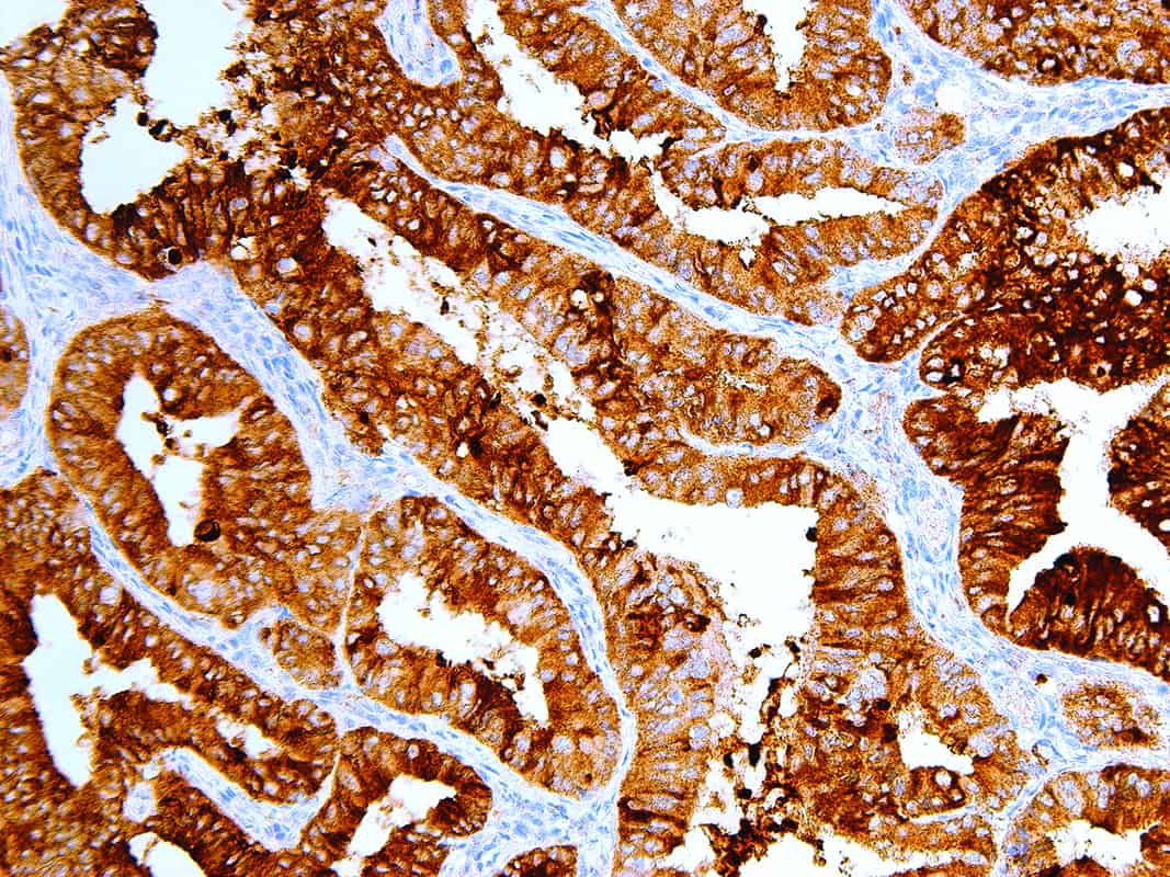 MUC1 | Medical Supply Company