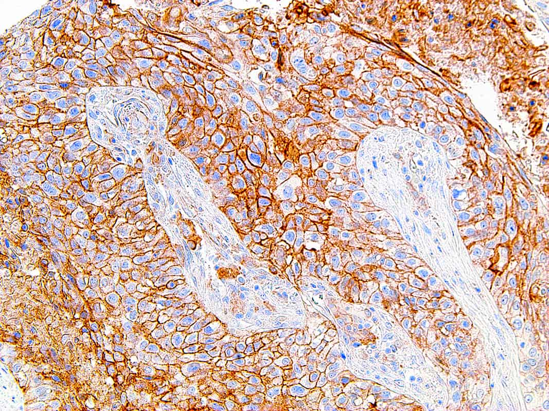 PD-L1 | Medical Supply Company