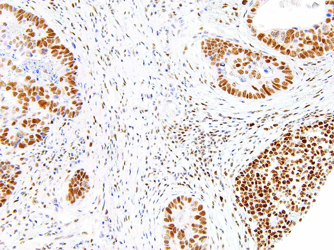 PMS2 Medical Supply Company