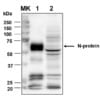 Rabbit Anti-SARS-CoV-2 Nucleocapsid Protein | Medical Supply Company