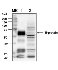 Rabbit Anti-SARS-CoV-2 Nucleocapsid Protein | Medical Supply Company