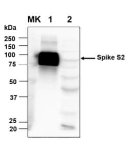 Rabbit Anti-SARS-CoV-2 Spike Protein | Medical Supply Company