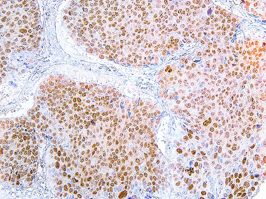 SOX 2 Medical Supply Company