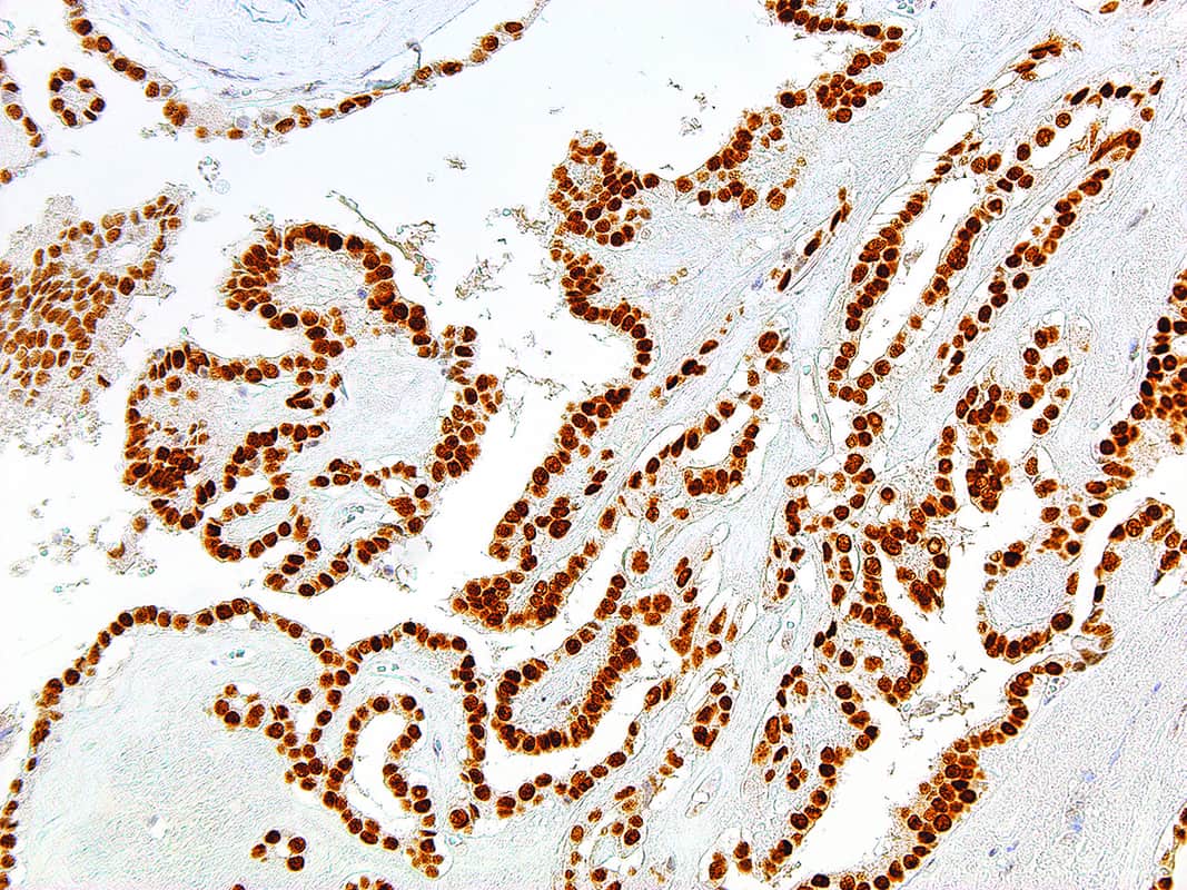 TTF-1 | Medical Supply Company