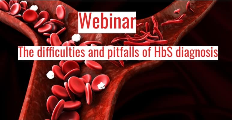 The difficulties and pitfalls of HbS diagnosis, sickle cell, sickle cell disease | Medical Supply Company