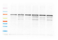 Vilber Fusion FX7 for western blots | Medical Supply Company