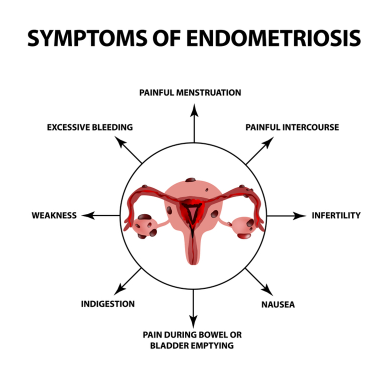 March Endometriosis Awareness Month | Medical Supply Company