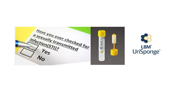 UriSponge™, STI, HPV Sample Collection, STD | Medical Supply Company