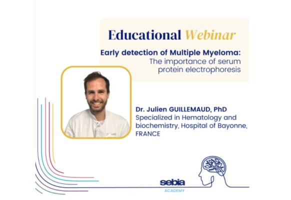 Early detection of Multiple Myeloma: The importance of serum protein electrophoresis | Medical Supply Company