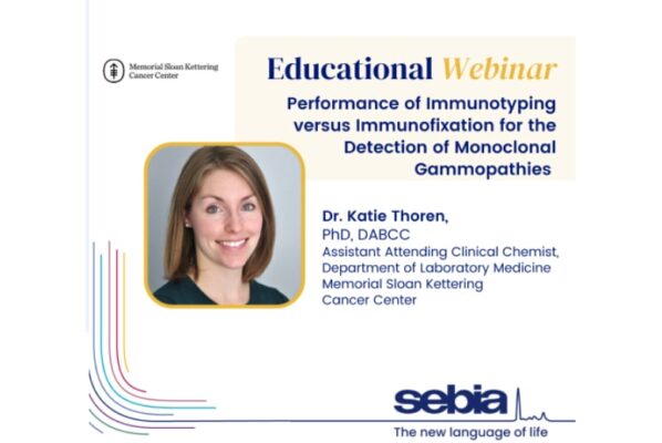 Immunofixation for the Detection of Monoclonal Gammopathies | Medical Supply Company