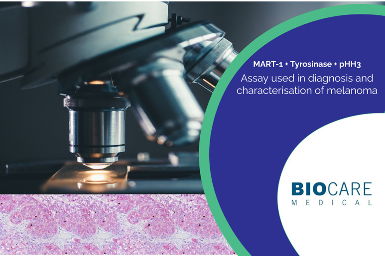MART-1 + Tyrosinase + pHH3 | Medical Supply Company